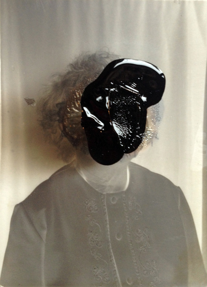 clinckx photo burned